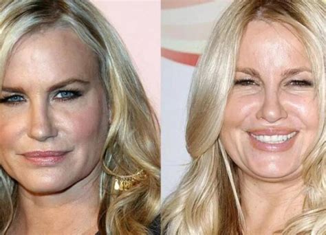 Jennifer Coolidge Plastic Surgery: Shocking Before and After Look!